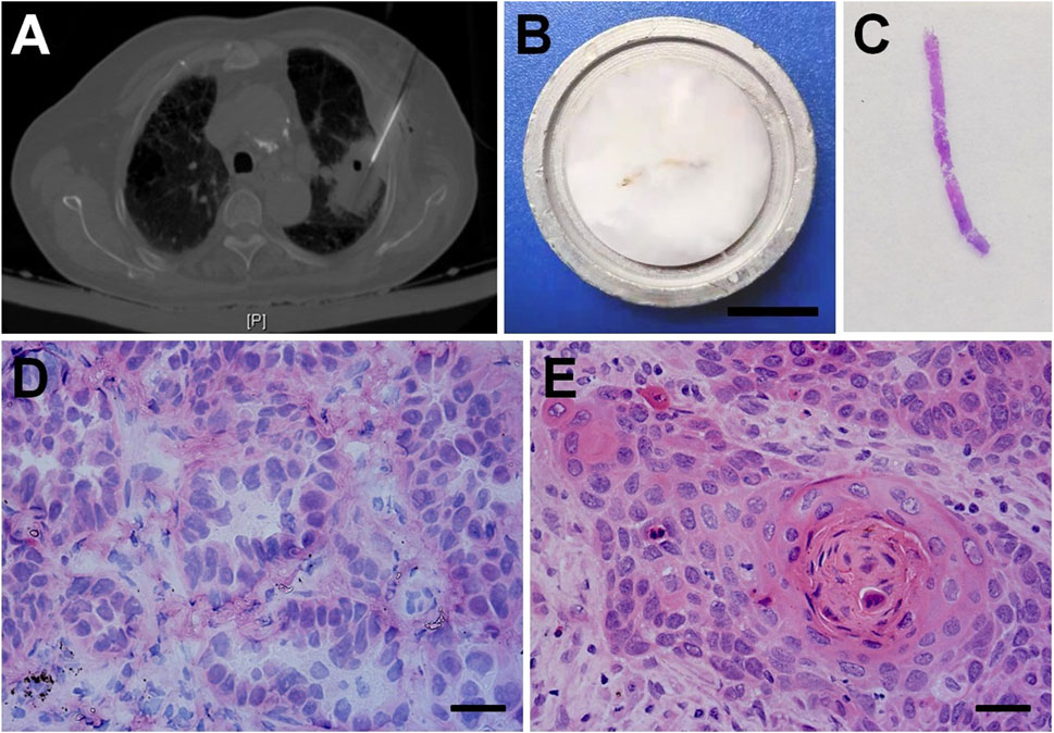Pathology & Oncology Research | Comparison of Multi-Gene