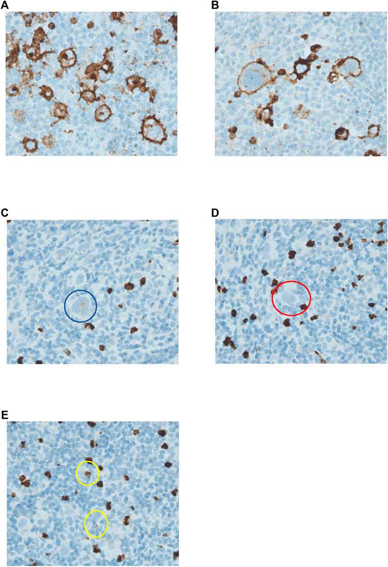 健康・医学 Diagnostic Immunohistochemistry Diagnostic Immunohistochemistry: Theranostic and Genomic