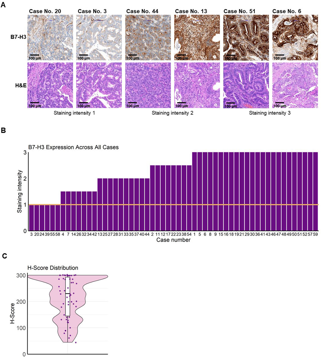 Pathology & Oncology Research | B7-H3: a consistent marker